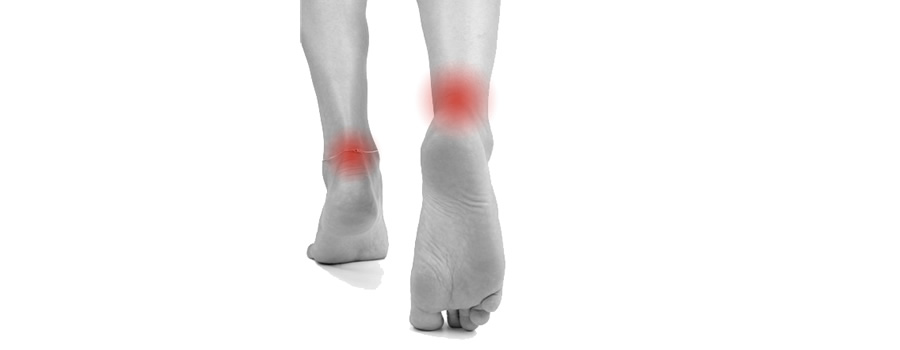 Casos clínicos relacionados con el tobillo y pie