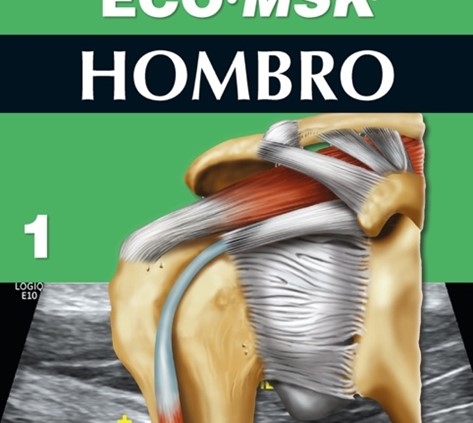 Eco MSK 1 Hombro